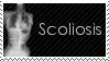 scoliosis_stamp_by_xxxprincessizzyxxx.gif